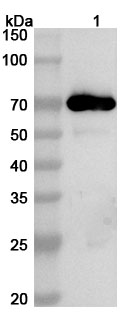 Anti-Mycoplasma pneumoniae CARDS Polyclonal Antibody binds to Recombinant Mycoplasma pneumoniae CARDS Protein, N-His in WB Assay