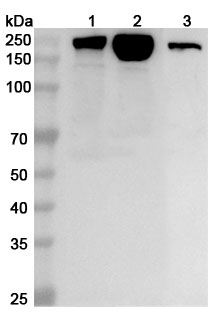 Anti-MYH7 Polyclonal antibody binds to Recombinant Human MYH7, N-His in WB Assay
