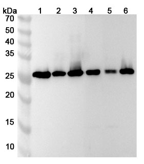 Anti-NAA10 Polyclonal Antibody binds to Recombinant Human NAA10 Protein, N-His in WB Assay