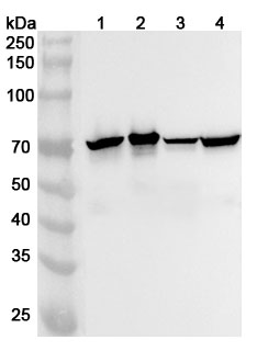 Anti-NEFL Polyclonal antibody binds to Recombinant Human NEFL, N-His in WB Assay