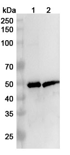 Anti-Neisseria meningitidis FHbp Polyclonal Antibody binds to Recombinant Neisseria meningitidis FHbp Protein, C-His in WB Assay