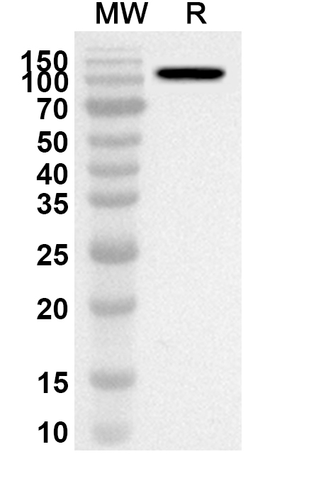 Anti-NFKB1 Polyclonal antibody binds to Recombinant Human NFKB1 Protein, N-His in WB Assay