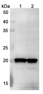 Anti-NME6 Polyclonal antibody binds to Recombinant Human NME6, N-His in WB Assay