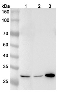 Anti-NQO1 Polyclonal antibody binds to Recombinant Human NQO1, N-His in WB Assay