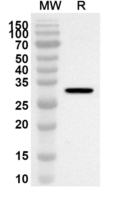 Anti-OCLN Polyclonal antibody binds to Recombinant Human OCLN, N-His in WB Assay