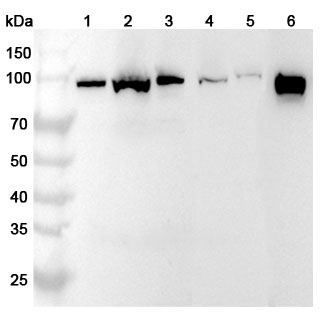 Anti-PDCD6IP Polyclonal antibody binds to Human PDCD6IP Recombinant Protein, N-His in WB Assay