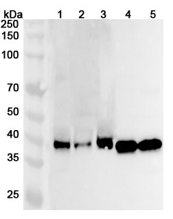 Anti-PDHA2 Polyclonal Antibody binds to Recombinant Human PDHA2 Protein, N-His in WB Assay