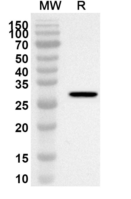 Anti-PDHX Polyclonal antibody binds to Recombinant Human PDHX, N-His in WB Assay