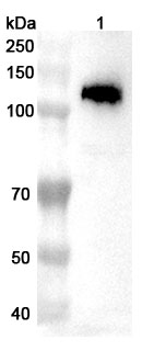 Anti-PKN1 Polyclonal Antibody binds to Recombinant Human PKN1 Protein, N-His in WB Assay