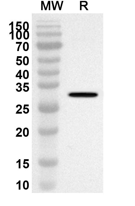 Anti-PLEC Polyclonal antibody binds to Human PLEC Recombinant Protein, N-His in WB Assay