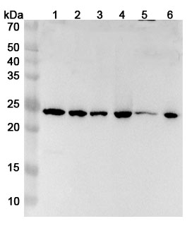 Anti-PSMB3 Polyclonal Antibody binds to Recombinant Human PSMB3 Protein, N-His in WB Assay