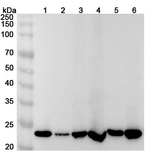 Anti-PSMB4 Polyclonal Antibody binds to Recombinant Human PSMB4 Protein, N-His in WB Assay