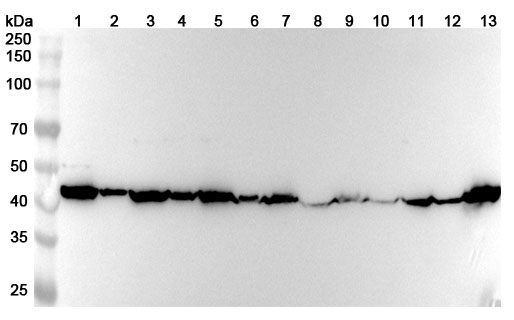 Anti-PSMC6 Polyclonal antibody binds to Recombinant Human PSMC6, N-His in WB Assay
