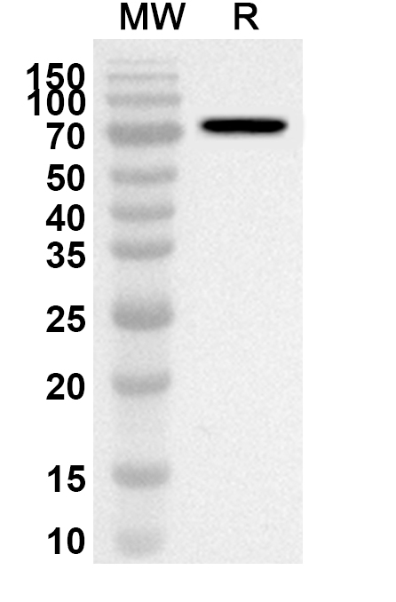 Anti-PSMD6 Polyclonal antibody binds to Recombinant Human PSMD6, N-GST in WB Assay
