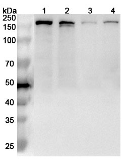 Anti-RAD50 Polyclonal antibody binds to Recombinant Human RAD50, N-His in WB Assay