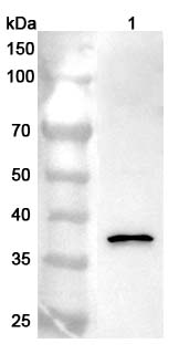 Anti-RAD51 Polyclonal antibody binds to Recombinant Human RAD51, N-His in WB Assay