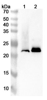 Anti-Rat LCN2 Polyclonal Antibody binds to Rat LCN2 Recombinant Protein, N-His in WB Assay