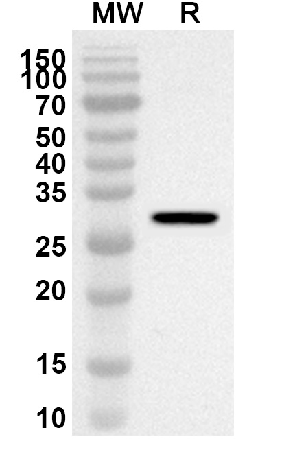 Anti-RENBP Polyclonal antibody binds to Recombinant Human RENBP, N-His in WB Assay