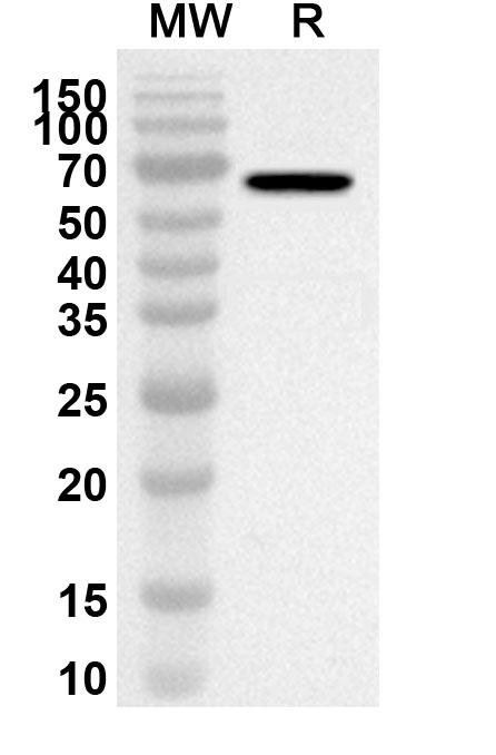 Anti-RET Polyclonal antibody binds to Human RET Recombinant Protein, N-His in WB Assay