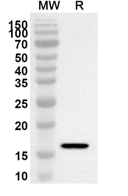 Anti-RGS1 Polyclonal Antibody binds to Recombinant Human RGS1 Protein, N-His in WB Assay