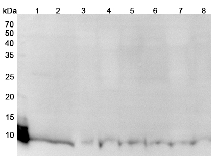 Anti-S100A12 Polyclonal antibody binds to Recombinant Human S100A12, N-His in WB Assay