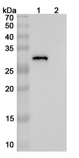 Anti-SARS-CoV-2 RBD Monoclonal Antibody (VIR-7229) binds to Recombinant SARS-CoV-2 RBD (B.1.1.523) Protein, C-His in WB Assay