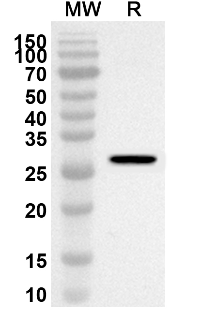 Anti-SCO2 Polyclonal antibody binds to Recombinant Human SCO2, N-His in WB Assay