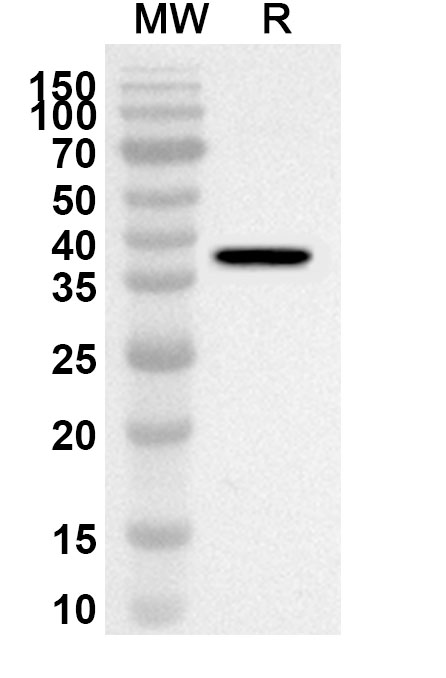 Anti-SEMA5A Polyclonal antibody binds to Recombinant Human SEMA5A, N-His in WB Assay