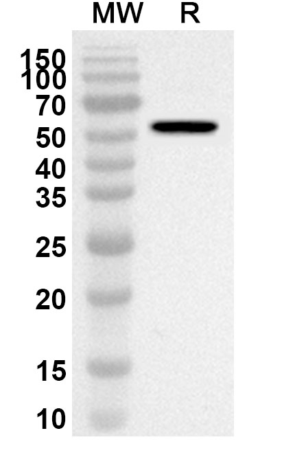 Anti-SIAE Polyclonal antibody binds to Recombinant Human SIAE, N-GST in WB Assay