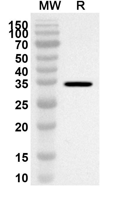 Anti-SLC17A5 Polyclonal Antibody binds to Recombinant Human SLC17A5 Protein, N-GST & C-His in WB Assay