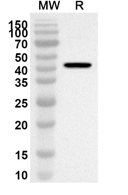 Anti-SNV Glycoprotein Gn Polyclonal Antibody in WB Assay