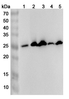 Anti-SOSTDC1 Polyclonal antibody binds to Recombinant Human SOSTDC1, N-His in WB Assay