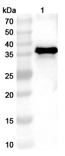 Anti-Staphylococcus aureus lukF-PV Polyclonal Antibody binds to Recombinant Staphylococcus aureus lukF-PV Protein, N-His in WB Assay