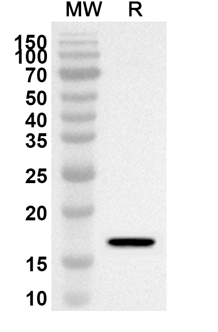 Anti-STMN1 Polyclonal antibody binds to Recombinant Human STMN1, N-His in WB Assay