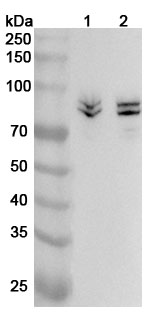 Anti-SYN1 Polyclonal antibody binds to Recombinant Human SYN1, N-His in WB Assay