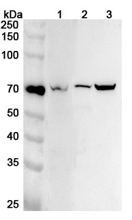 Anti-TEC Polyclonal Antibody binds to Recombinant Human TEC Protein, N-His in WB Assay