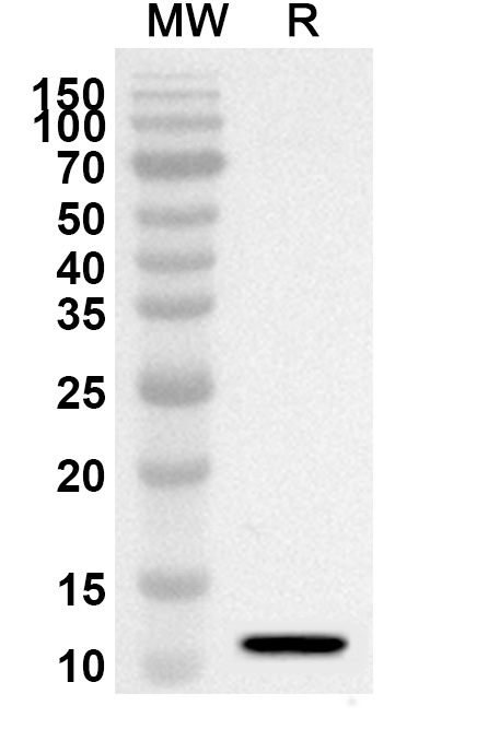 Anti-TGFBR1 Polyclonal Antibody binds to Human TGFBR1 recombinant protein in WB Assay