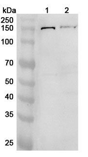 Anti-TGFBR3 Polyclonal Antibody binds to Mouse TGFBR3 Recombinant Protein, C-His in WB Assay