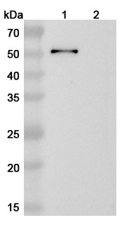Anti-Toxoplasma gondii SAG1/Major surface antigen p30 Antibody (ABS0225)