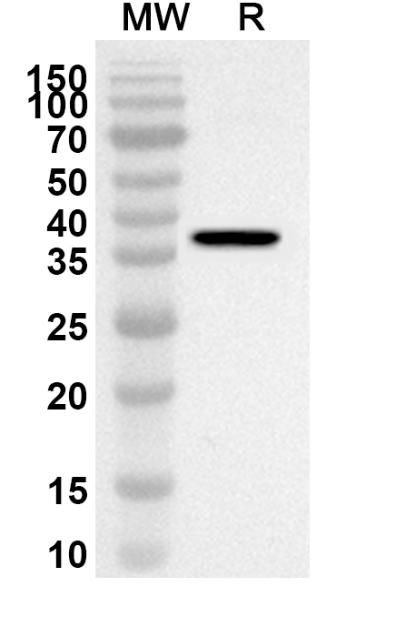 Anti-UCN2 Polyclonal antibody binds to Recombinant Human UCN2, N-GST in WB Assay