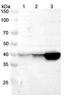 Anti-UPB1 Polyclonal antibody binds to Recombinant Human UPB1, N-His in WB Assay
