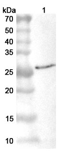 Anti-Vaccinia virus/VACV L4R/VP8 Polyclonal Antibody in WB Assay