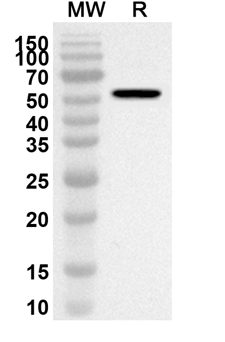 Anti-VSIV G protein/Glycoprotein G Polyclonal Antibody binds to Vesicular stomatitis Indiana virus VSIV G  recombinant protein in WB Assay