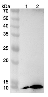 B2M Polyclonal Antibody binds to B2M, C-His, recombinant protein in WB Assay