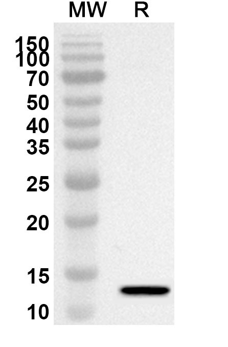 CCL24 / Eotaxin-2 / MPIF-2 Polyclonal Antibody in WB Assay