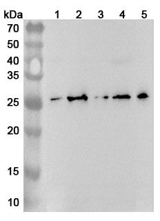 CD254 / RANKL / TNFSF11 Polyclonal Antibody  in WB Assay