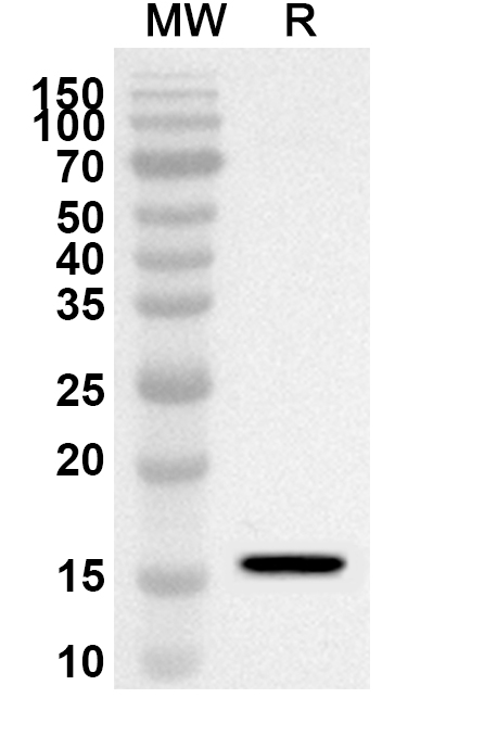 CD292 / BMPR1A Polyclonal Antibody  in WB Assay