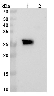 Cinrebafusp alfa Biosimilar - Anti-CD137 fusion protein - Research Grade binds to Mouse CD137 recombinant protein in WB Assay