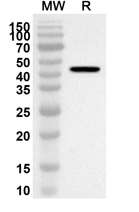 DSG3 Polyclonal Antibody  binds to Human DSG3 recombinant protein in WB Assay