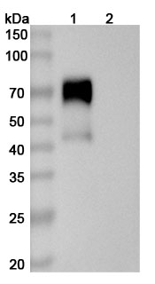 Human CD126/IL6R/IL-6RA (SAA0048) Monoclonal Antibody binds to Mouse CD126 recombinant protein in WB Assay